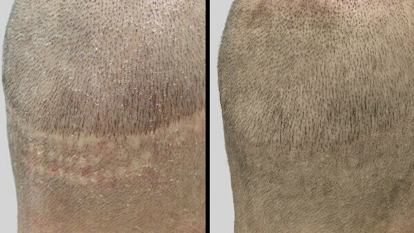 PHAEYDE Hair Transplant Clinic PHAEYDE Hair Transplant Clinic