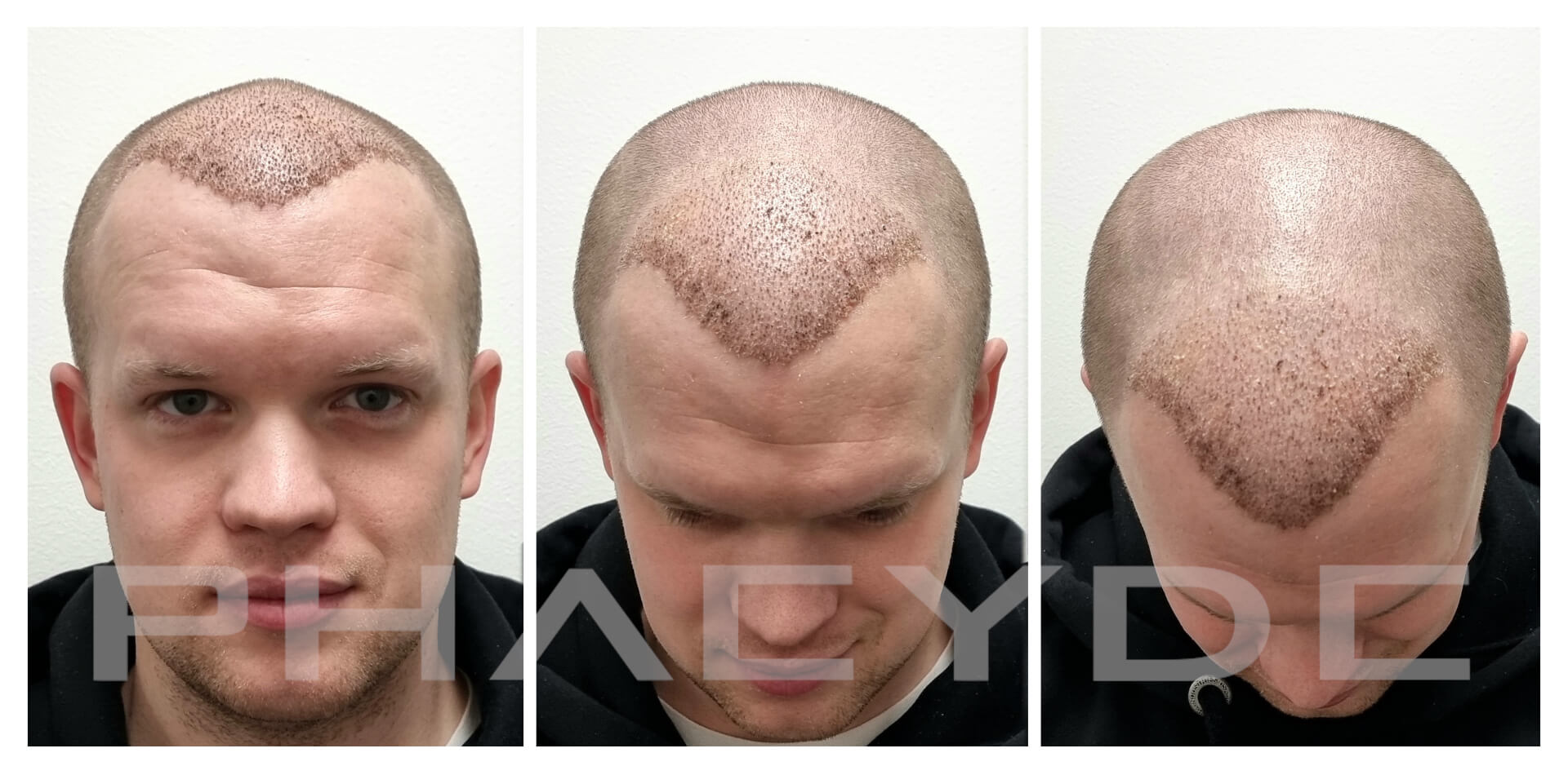 PHAEYDE Hair Transplant Clinic PHAEYDE Hair Transplant Clinic