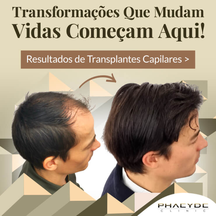 Hair Transplantation - Book a Treatment