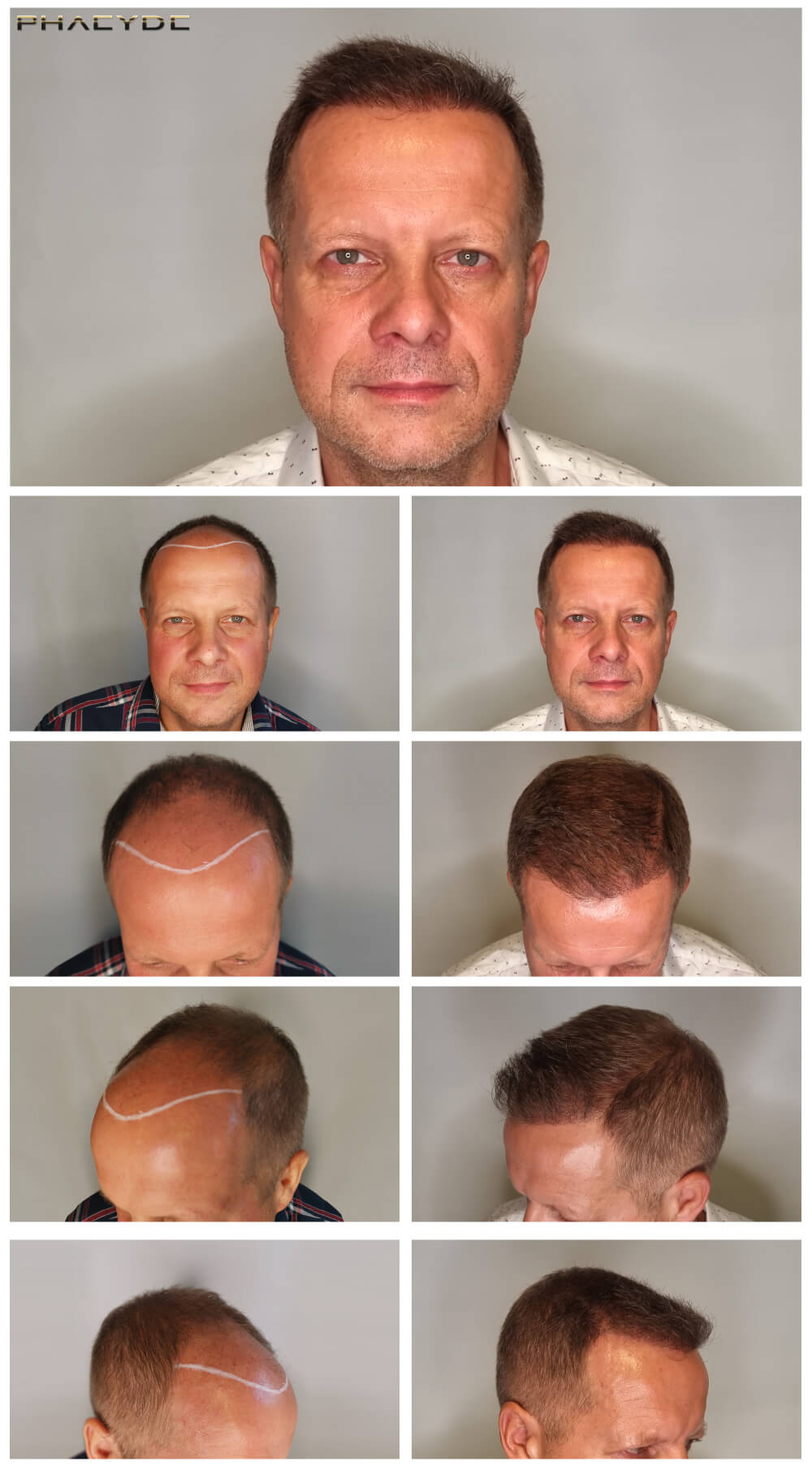 Marcel – 2600 Grafturi